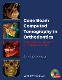Cone Beam Computed Tomography in Orthodontics. Indications, Insights, and Innovations