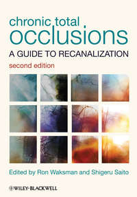 Chronic Total Occlusions. A Guide to Recanalization