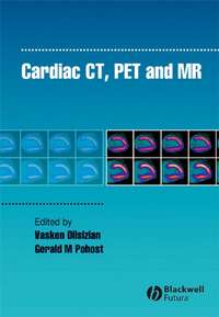 Cardiac CT, PET and MR