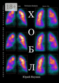 ХОБЛ. Хроническая обструктивная болезнь лёгких